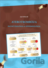 Aterotrombóza