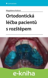 Ortodontická léčba pacientů s rozštěpem