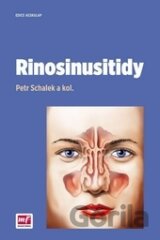 Rinosinusitidy