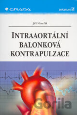 Intraaortální balonková kontrapulzace