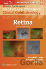Retina