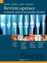 Revizní operace totálních náhrad kolenního kloubu