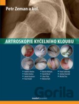 Artroskopie kyčelního kloubu