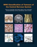 WHO Classification of Tumours of the Central Nervous System