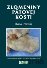 Zlomeniny pätovej kosti