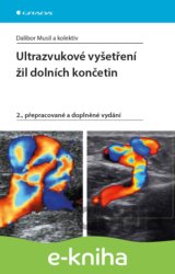 Ultrazvukové vyšetření žil dolních končetin