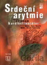 Srdeční arytmie aneb nejenom kardiostimulátor