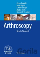Arthroscopy