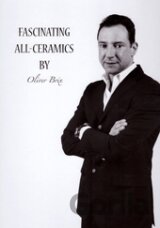 Fascinating All-Ceramics