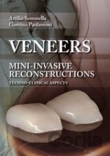 Veneers