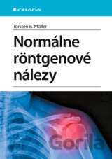 Normálne röntgenové nálezy