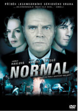 Normal