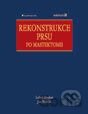 Rekonstrukce prsu po mastektomii