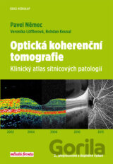 Optická koherenční tomografie