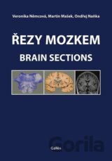 Řezy mozkem