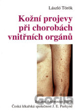Kožní projevy při chorobách vnitřních orgánů