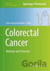 Colorectal Cancer
