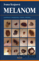 Melanom