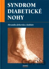 Syndrom diabetické nohy