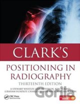 Clark's Positioning in Radiography