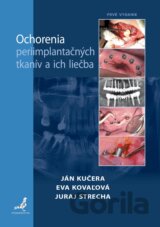 Ochorenia periimplantačných tkanív a ich liečba