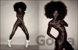 Schmolka X-Posed