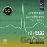 160 ECG Cases