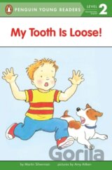 My Tooth Is Loose!