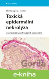 Toxická epidermální nekrolýza