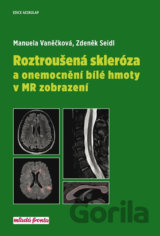 Roztroušená skleróza a onemocnění bílé hmoty v MR zobrazení