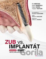 Zub vs. implantát