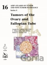 Tumors of the Ovary and Fallopian Tube