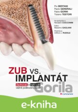 Zub vs. implantát