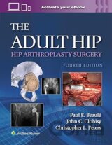 Adult Hip Hip Arthroplasty Surgery Print