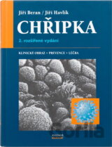Chřipka : klinický obraz, prevence a léčba