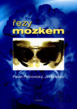 Řezy mozkem