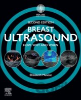 Breast Ultrasound, 2nd Edition