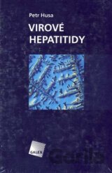 Virové hepatitidy