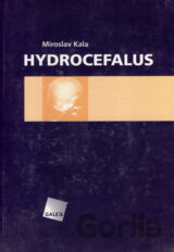 Hydrocefalus