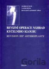 Revizní operace náhrad kyčelního kloubu
