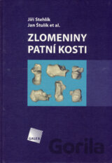 Zlomeniny patní kosti