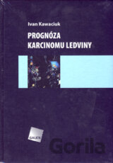 Prognóza karcinomu ledviny