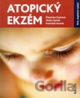 Atopický ekzém