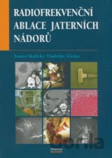 Radiofrekvenční ablace jaterních nádorů