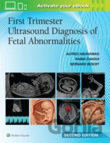 First Trimester Ultrasound Diagnosis of Fetal Abnormalities