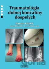 Traumatológia dolnej končatiny dospelých