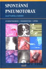 Spontánní pneumotorax