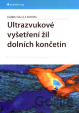 Ultrazvukové vyšetření žil dolních končetin