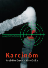 Karcinóm hrubého čreva a konečníka