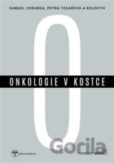 Onkologie v kostce